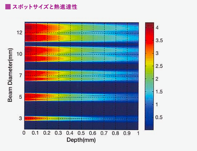 大口径スポットサイズ